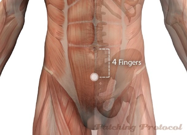 Patching Protocol Acupoint location for CV4 and Fatigue cases
