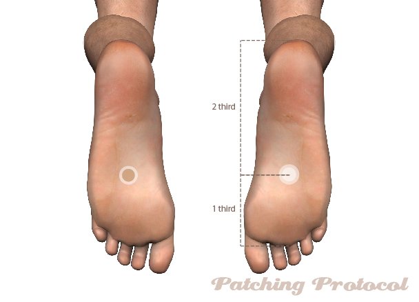 Patching Protocol Acupoint location for K1
