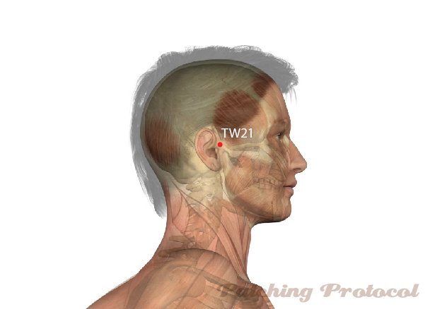 Patching Protocol Acupoint location for TW21
