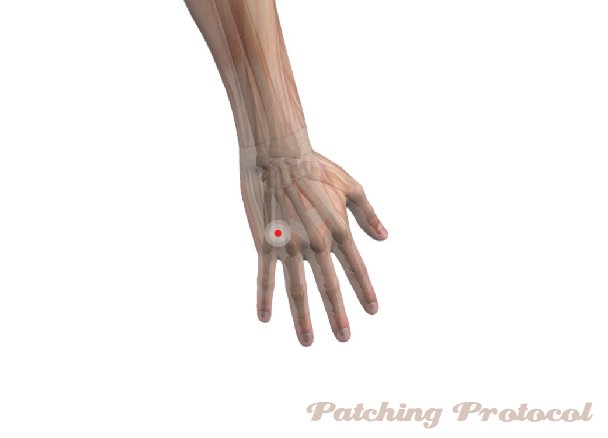 Patching Protocol Acupoint location for TW3