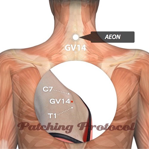 Lifewave AEON patches on Governing Vessel 14 or GV14 Acupuncture Position