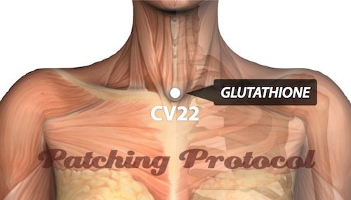LifeWave Glutathione Patches on Conception Vessel 22 or CV22 Acupuncture Position