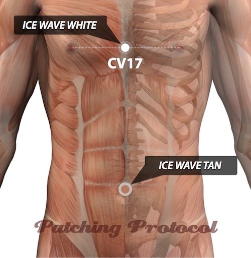 LifeWave Ice Wave Patches positions for cases of Acid Reflux