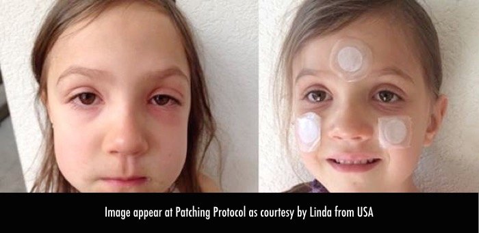 Using Lifewave AEON Patches