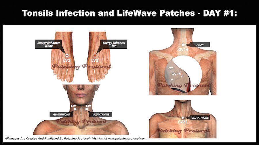 LifeWave Patches and Tonsils Infection