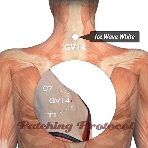 Lifewave patches on Governing Vessel 14 or GV14 Acupuncture Position using Lifewave Patches for Stress