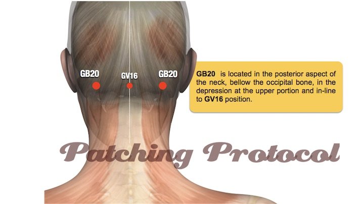 Lifewave Patches - Gallbladder 20 or GB20 Acupoint Position