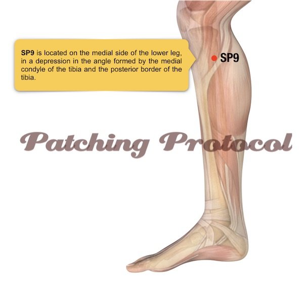 Lifewave Patches - Spleen 9 or SP9 Acupoint Position